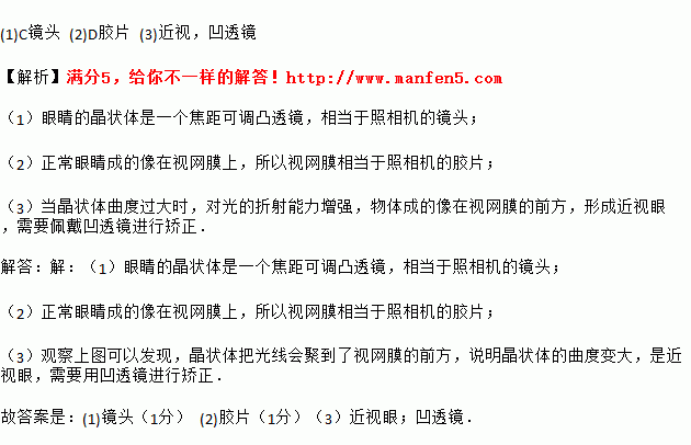 人的眼睛像一架照相机，从物体射出的光经过晶状体折射后成像于视网膜上，在视网膜上所成的像是（）