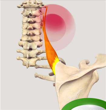 后背、肩胛骨区域疼痛、紧张或僵硬，是怎么回事？一文详细告知您